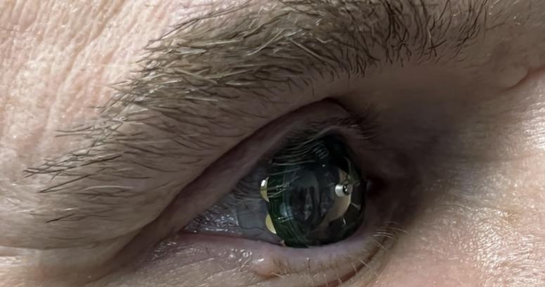 AR contact lenses are here, the price of a cell phone, officially opened the human wear test
